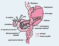 Roux-Y-Magenbypass