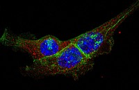 Murine colorectal cancer cells (green: EpCAM, red: e-cadherin, blue: DAPI)