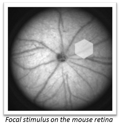 Neurovaskuläre Dysfunktion