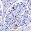 Nephropathologie