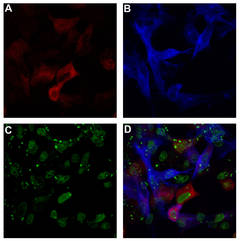 FIV infected cells co-expressing a neuroimmune regulator (NiReg)