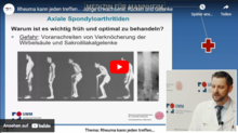 Welche Formen von Rheuma treten bereits in jungem Lebensalter auf? Wie kommt es zu der Erkrankung von Rücken und Gelenken? Wie werden rheumatische Erkrankungen diagnostiziert? Welche Risikofaktoren gibt es? Welche modernen Behandlungsmöglichkeiten gibt es bei rheumatischen Erkrankungen?